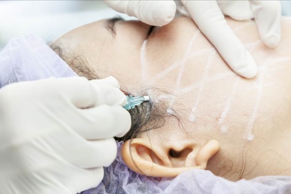 Thẩm mỹ ít xâm lấn: Xu hướng làm đẹp thời 4.0