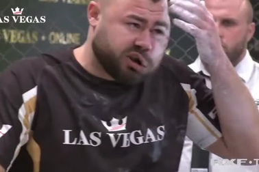 Võ sĩ biến dạng khuôn mặt khi nhận cú tát trời giáng