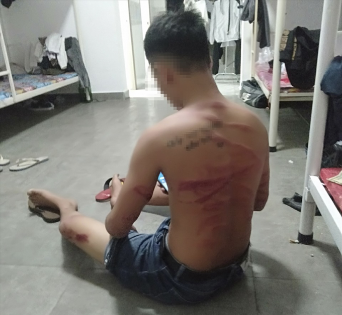 Một nạn nhân bỏ trốn thì bị công ty bắt lại đánh đập, chụp ảnh gửi về cho gia đình mang tiền sang chuộc.