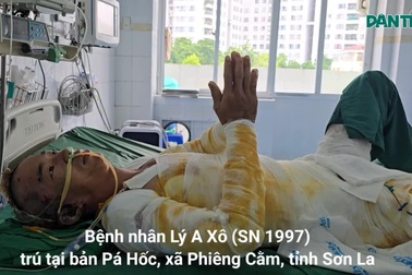 Người bố dân tộc Mông bỏng 64% cơ thể, chắp tay khẩn cầu: “Xin cứu em!”