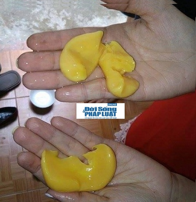 Trứng vịt có lòng trắng bám “như đỉa” gây hoang mang