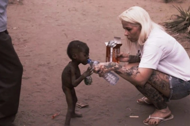 Cuộc sống hiện tại của cậu bé da bọc xương từng khiến cả thế giới ám ảnh