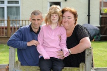 Hạnh phúc bất ngờ của cô gái từng bị bỏng đến biến dạng