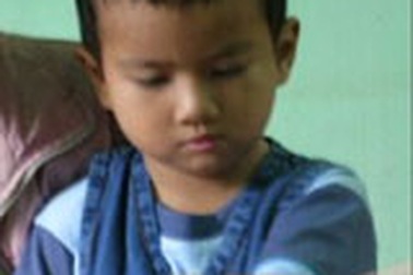 Lắp 25 tay giả miễn phí