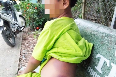 Cô giáo đánh học sinh khuyết tật bầm tím là người hiền lành