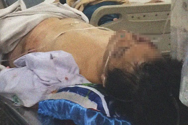 Nghi án một tài xế taxi bị cướp đâm trọng thương