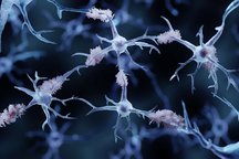 Truyền máu sẽ mở ra một hy vọng mới trong việc điều trị bệnh Alzheimer