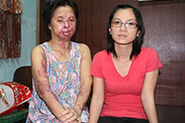 Cả nhà bị tạt axít