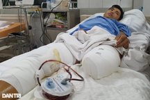 Cha nghèo bị đá đè nát 2 chân, bầy con thơ đói khát ngày đêm mong ngóng