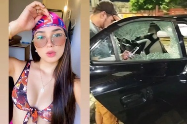 Người mẫu 20 tuổi chết sau khi bị bắn vào mặt