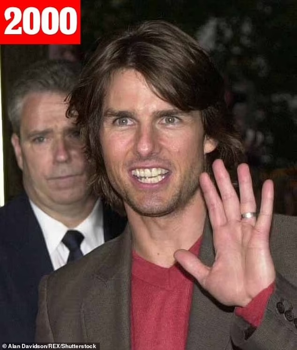 Tom Cruise không phải lúc nào cũng... cười đẹp như bây giờ - 3