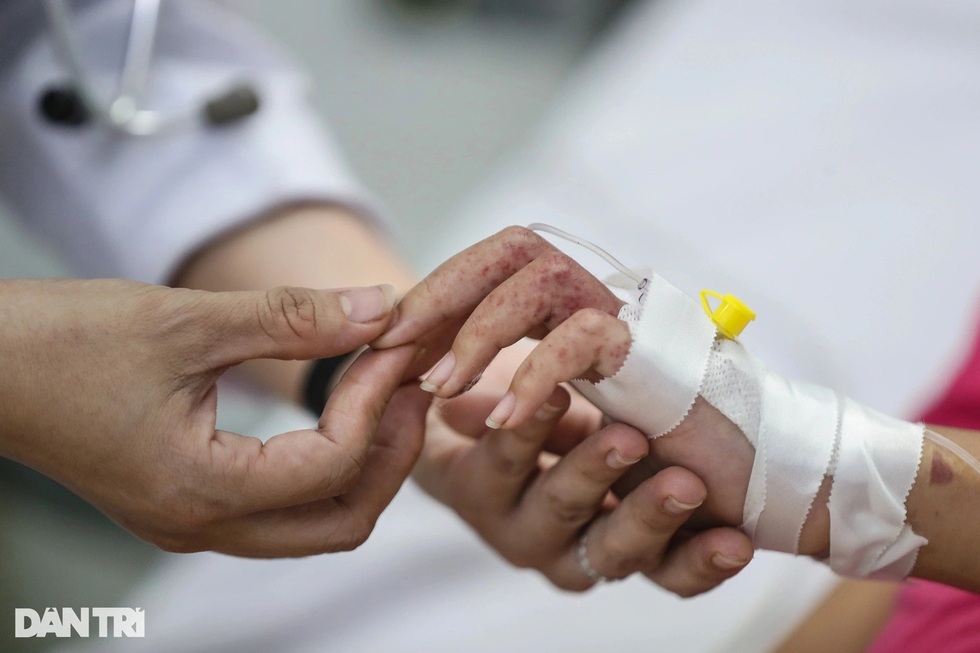 Ngỡ chỉ là cơn sốt nhẹ, người đàn ông rơi vào sốc sốt xuất huyết nguy kịch - 6 Ngỡ chỉ là cơn sốt nhẹ, người đàn ông rơi vào sốc sốt xuất huyết nguy kịch - 6