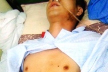 Bắc Ninh: Đề nghị làm rõ vụ bắt cóc, tra tấn "thập tử nhất sinh" một nam thanh niên