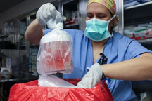 Mỹ lần đầu tiên ghép thận lợn cho người đang sống