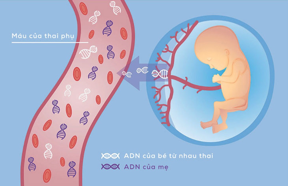 Sàng lọc trước sinh không xâm lấn NIPT - Illumina: Giải pháp an toàn cho mẹ và bé - 1 Sàng lọc trước sinh không xâm lấn NIPT - Illumina: Giải pháp an toàn cho mẹ và bé - 1