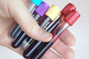 Hà Nội: Miễn phí xét nghiệm men gan