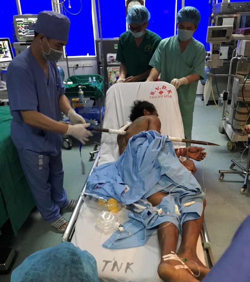 Sốc: Xà beng đâm xuyên ngực qua lưng người đàn ông  - 1