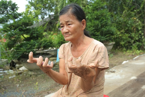 Nhà lá 30 năm bị cuốn sập, người phụ nữ tật nguyền sống nhờ hàng xóm