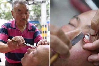 Rùng rợn nghề lấy dao... cạo mắt