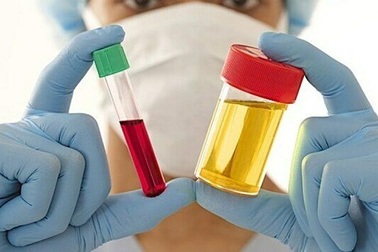 Đau lưng, tiểu ra máu thận trọng với ung thư niệu quản