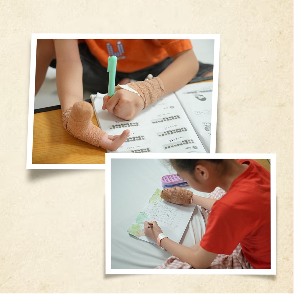Có một ước mơ được bình thường như các bạn của chị em dị tật bẩm sinh - 2 Có một ước mơ được bình thường như các bạn của chị em dị tật bẩm sinh - 2