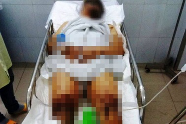 Nhận dạng 2 đối tượng vụ tạt axit gây rúng động