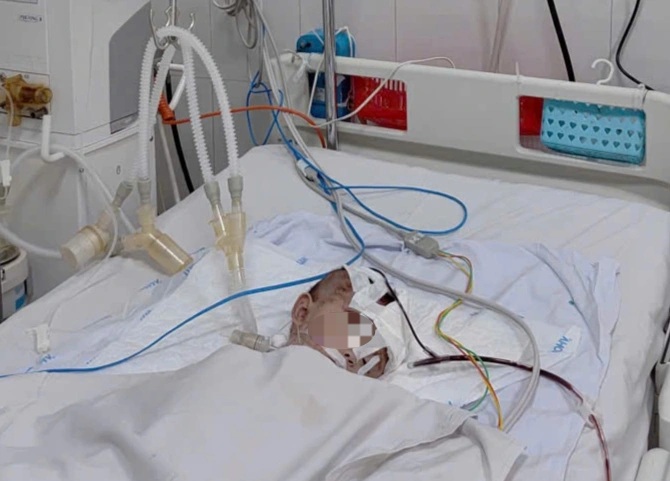 Bệnh viện báo động đỏ cấp cứu 7 người bị tai nạn giao thông nghiêm trọng - 2