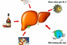Các yếu tố làm tăng nguy cơ ung thư gan