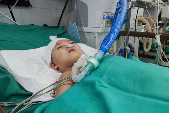 Bé gái 8 tuổi nguy kịch sau tai nạn, gia đình nghèo khẩn cầu sự giúp đỡ