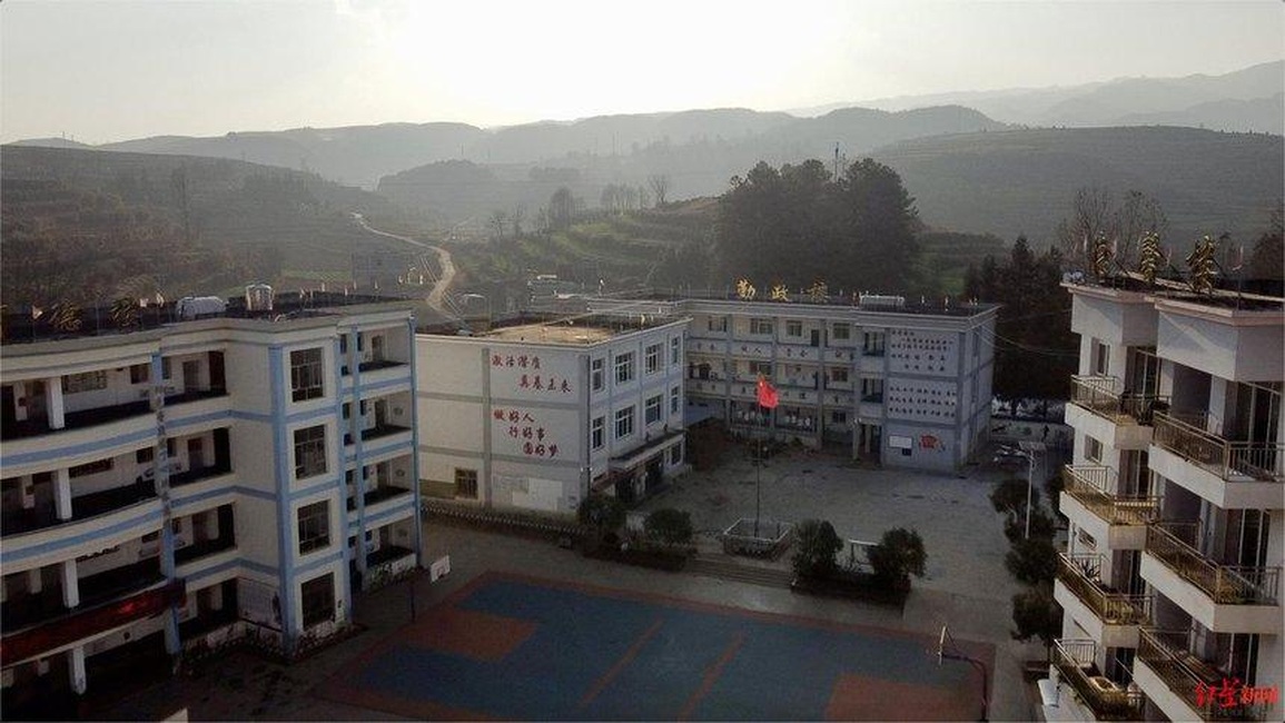 Cuộc sống thay đổi ngoạn mục của cậu bé với mái tóc đóng băng đến lớp - 2 Cuộc sống thay đổi ngoạn mục của cậu bé với mái tóc đóng băng đến lớp - 2