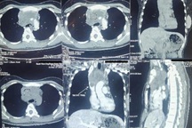 Nhiều người phát hiện bệnh "hiểm" từ triệu chứng tưởng bình thường
