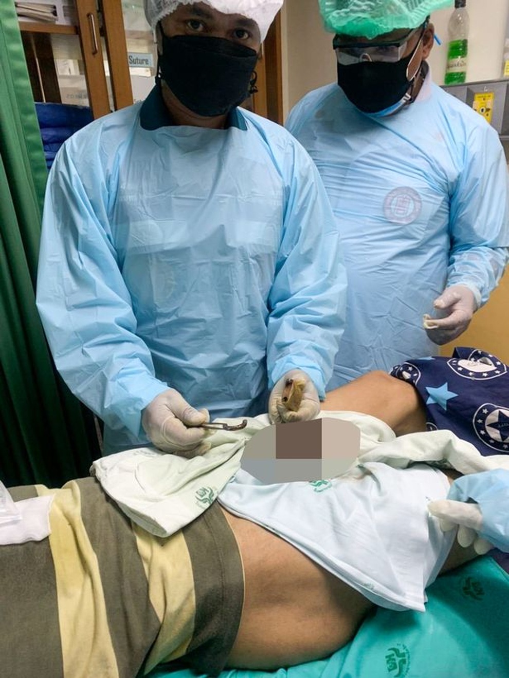 Người đàn ông có của quý bị biến dạng vĩnh viễn do mắc kẹt trong ổ khóa - 1 Người đàn ông có của quý bị biến dạng vĩnh viễn do mắc kẹt trong ổ khóa - 1