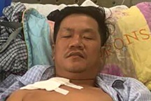 Bị xịt hơi cay khi đuổi kẻ trộm xe máy, "hiệp sĩ" gặp tai nạn trọng thương