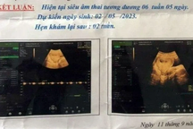 Bắt khẩn cấp bảo vệ trường học nghi xâm hại khiến nữ sinh lớp 6 mang thai