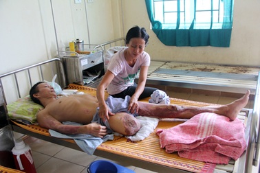 Nỗi đau của người cha mất tay trái, cụt chân phải