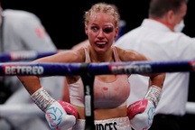 Kinh hãi gương mặt sưng húp của nữ võ sĩ sau trận đấu tàn khốc