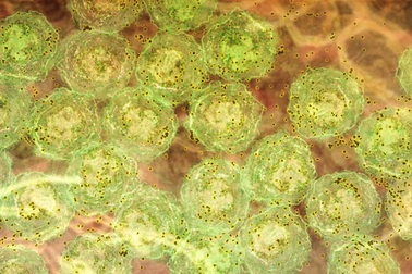 Phương pháp điều trị HIV kiểu mới nhờ… bệnh sốt rét