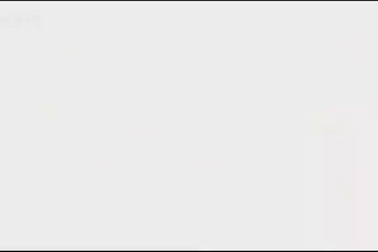 Bê hai mặt hiếm có chào đời ở Mỹ