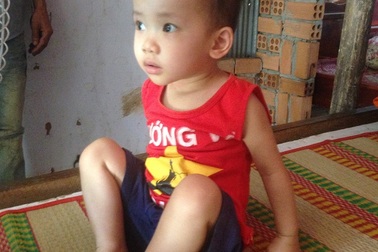 Thiếu tiền phẫu thuật, cha mẹ nghèo đưa con gái 18 tháng suy tim về nhà trong bế tắc