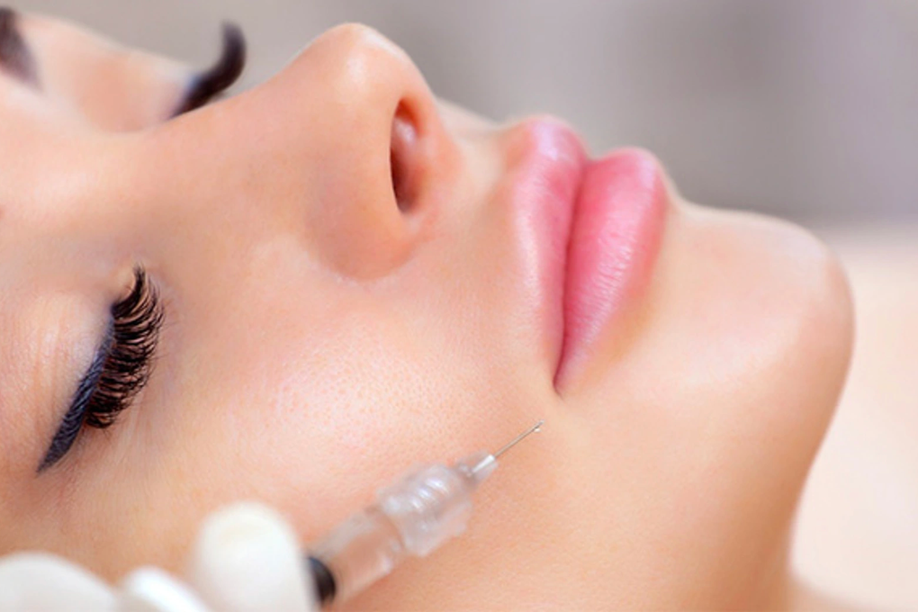 Đi tiêm tan filler ở thẩm mỹ viện: Cẩn thận lành thành què - 4 Đi tiêm tan filler ở thẩm mỹ viện: Cẩn thận lành thành què - 4