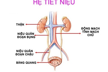 Có các dấu hiệu này coi chừng ung thư niệu quản