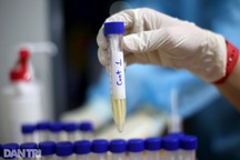 Trưa 13/5, thêm 21 ca Covid-19 tại 7 địa phương, nhiều nhất là Bắc Giang