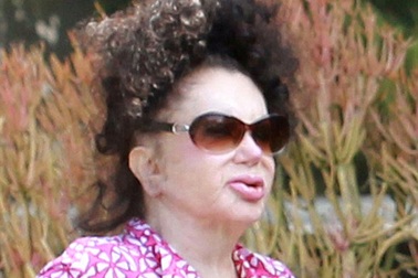 92 tuổi, “thảm họa phẫu thuật thẩm mỹ” vẫn miệt mài giữ dáng 