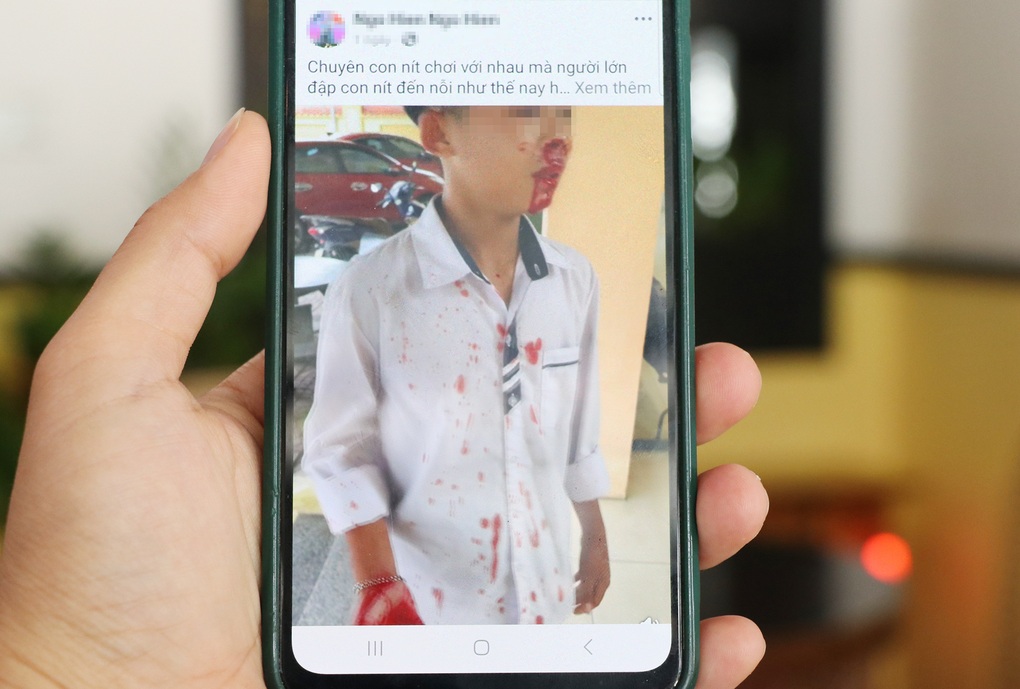 Bé trai 13 tuổi bị hàng xóm đánh chảy máu mũi - 1 Bé trai 13 tuổi bị hàng xóm đánh chảy máu mũi - 1