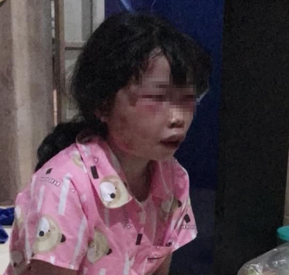 Bất ngờ về hung thủ đánh dã man nữ sinh lớp 6 trong lô cao su - 2 Bất ngờ về hung thủ đánh dã man nữ sinh lớp 6 trong lô cao su - 2