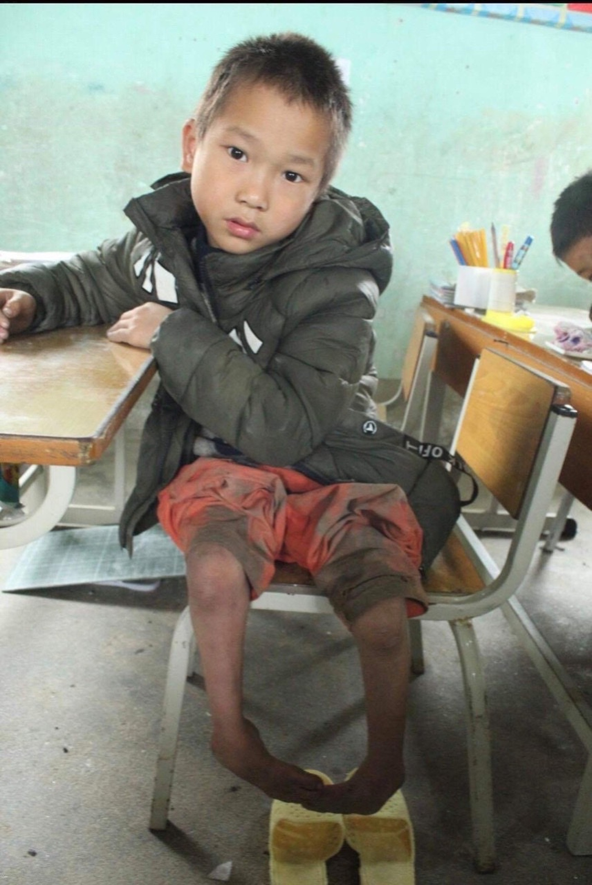 Cậu bé Nùng liệt 2 chân đổi đời nhờ người mẹ nuôi - 1 Cậu bé Nùng liệt 2 chân đổi đời nhờ người mẹ nuôi - 1