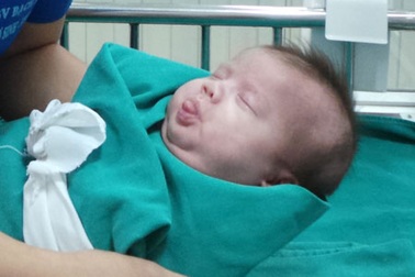 Cứu sống trẻ 800gram suy thận cấp ngay khi vừa lọt lòng