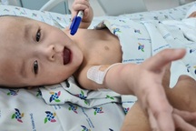 Cặp song nhi chuẩn bị những bước đi đầu đời sau phẫu thuật tách dính