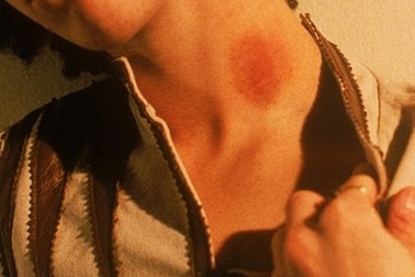 Chàng trai bất ngờ thiệt mạng sau khi bị bạn gái cắn yêu