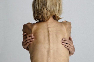 Chán ăn có thể là do cơ thể bị nhiễm khuẩn